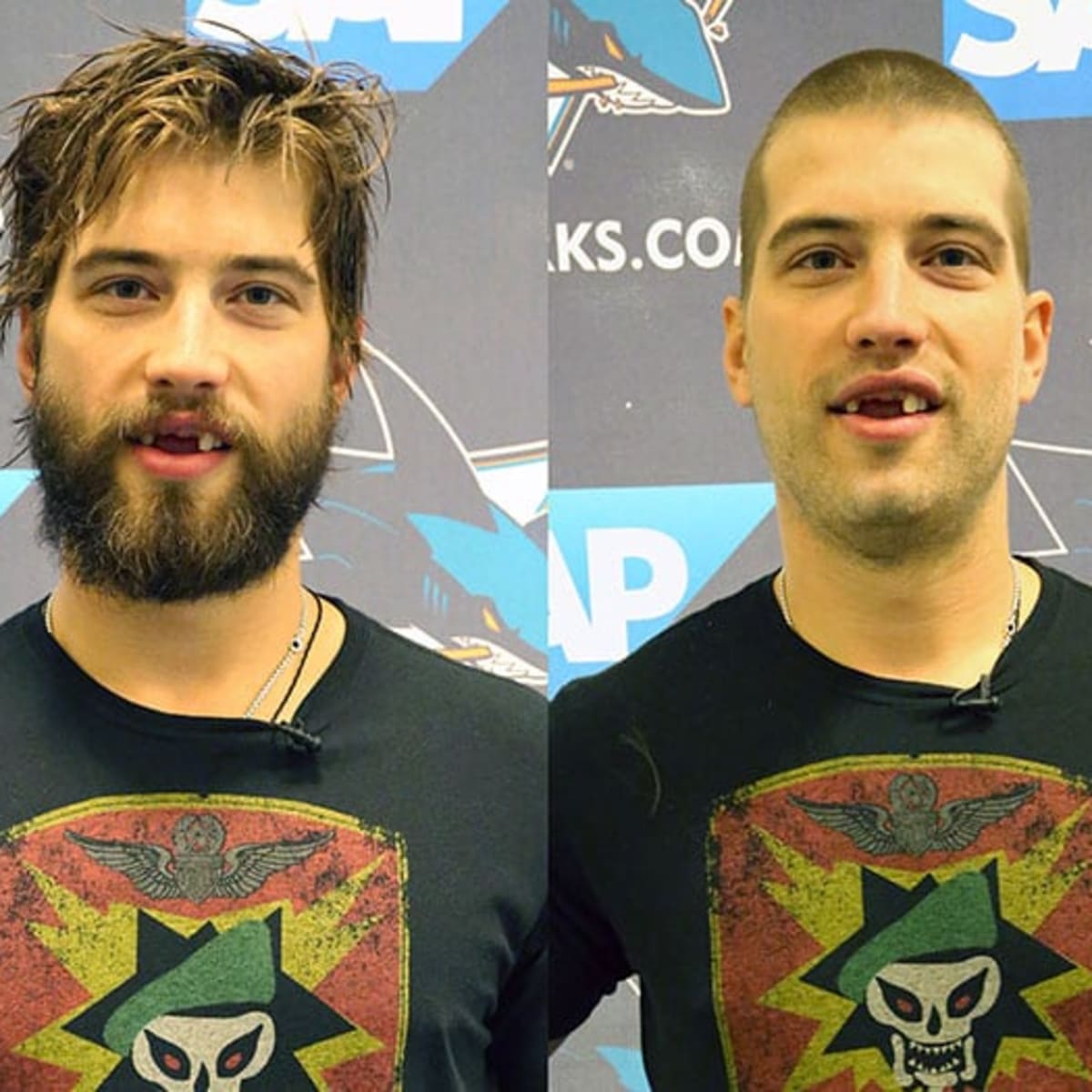 Brent Burns, the NHL's hairiest man, is now completely clean-shaven